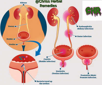 Urinary infections